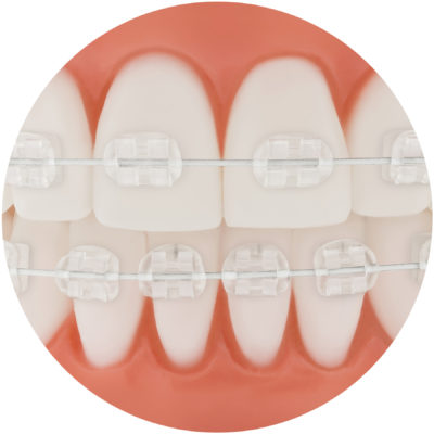 Archwires - TP Orthodontics