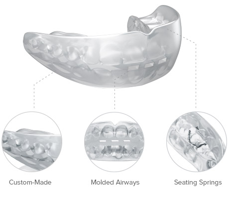 Archwires - TP Orthodontics